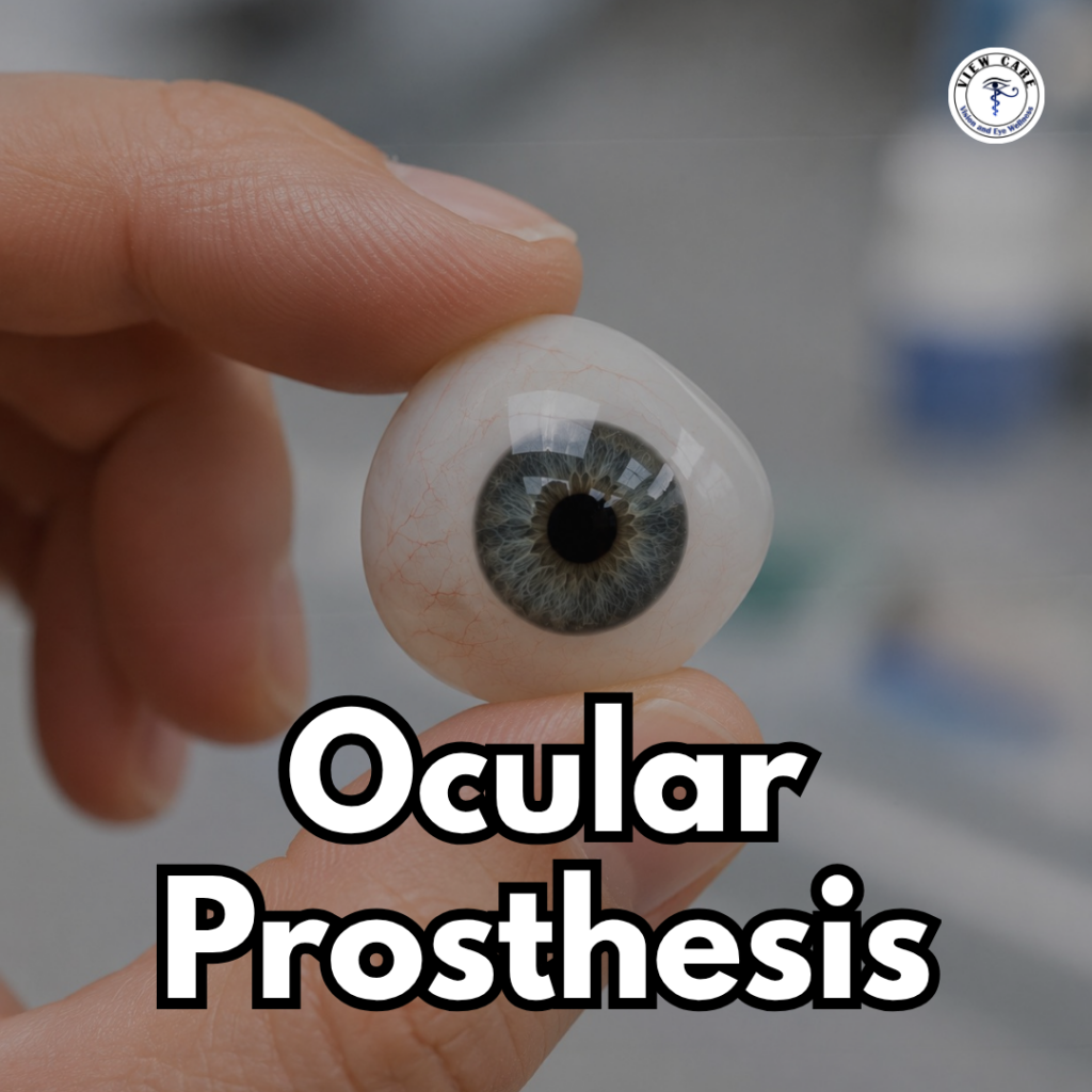 Can an Ocular Prosthesis Restore Confidence and Help You Live a Normal Life?